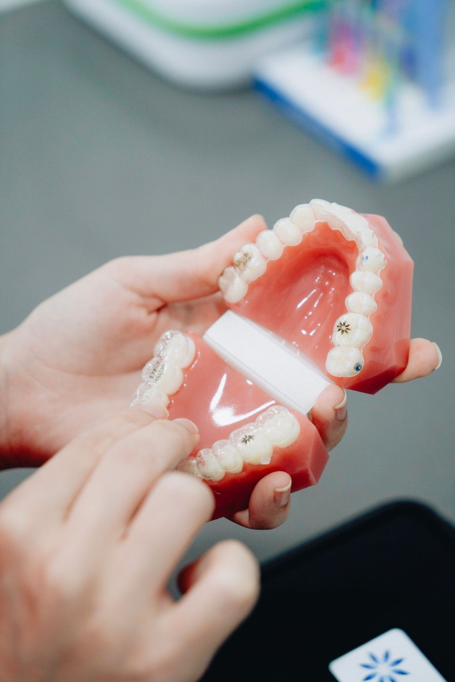 Modelo dentário com aparelho ortodôntico